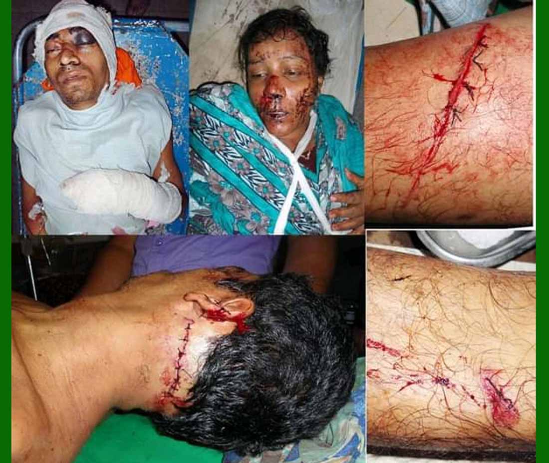 ২০১২ সালে বরিশালের মুলাদী উপজেলার সফিপুর ইউনিয়নে দূর্ধর্ষ ডাকাতির পর স্বামী স্ত্রীকে কুপিয়ে জখম-ফাইল ফটো