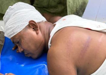গৌরনদীতে সাবেক কাউন্সিলরকে পিটিয়ে রক্তাক্ত জখম