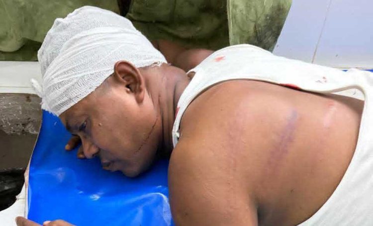 গৌরনদীতে সাবেক কাউন্সিলরকে পিটিয়ে রক্তাক্ত জখম