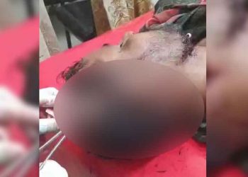 বিয়ের দাওয়াত না দেওয়াকে কেন্দ্র করে হামলা, গুরুতর আহত ৩