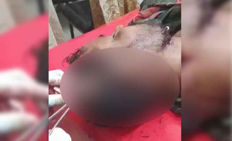 বিয়ের দাওয়াত না দেওয়াকে কেন্দ্র করে হামলা, গুরুতর আহত ৩