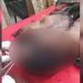 বিয়ের দাওয়াত না দেওয়াকে কেন্দ্র করে হামলা, গুরুতর আহত ৩